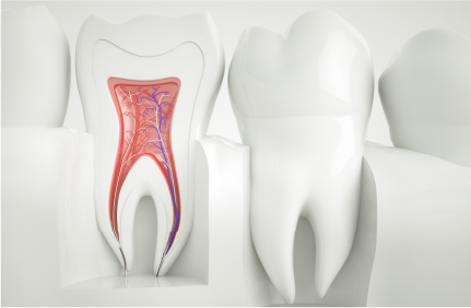 Root Canal Treatment