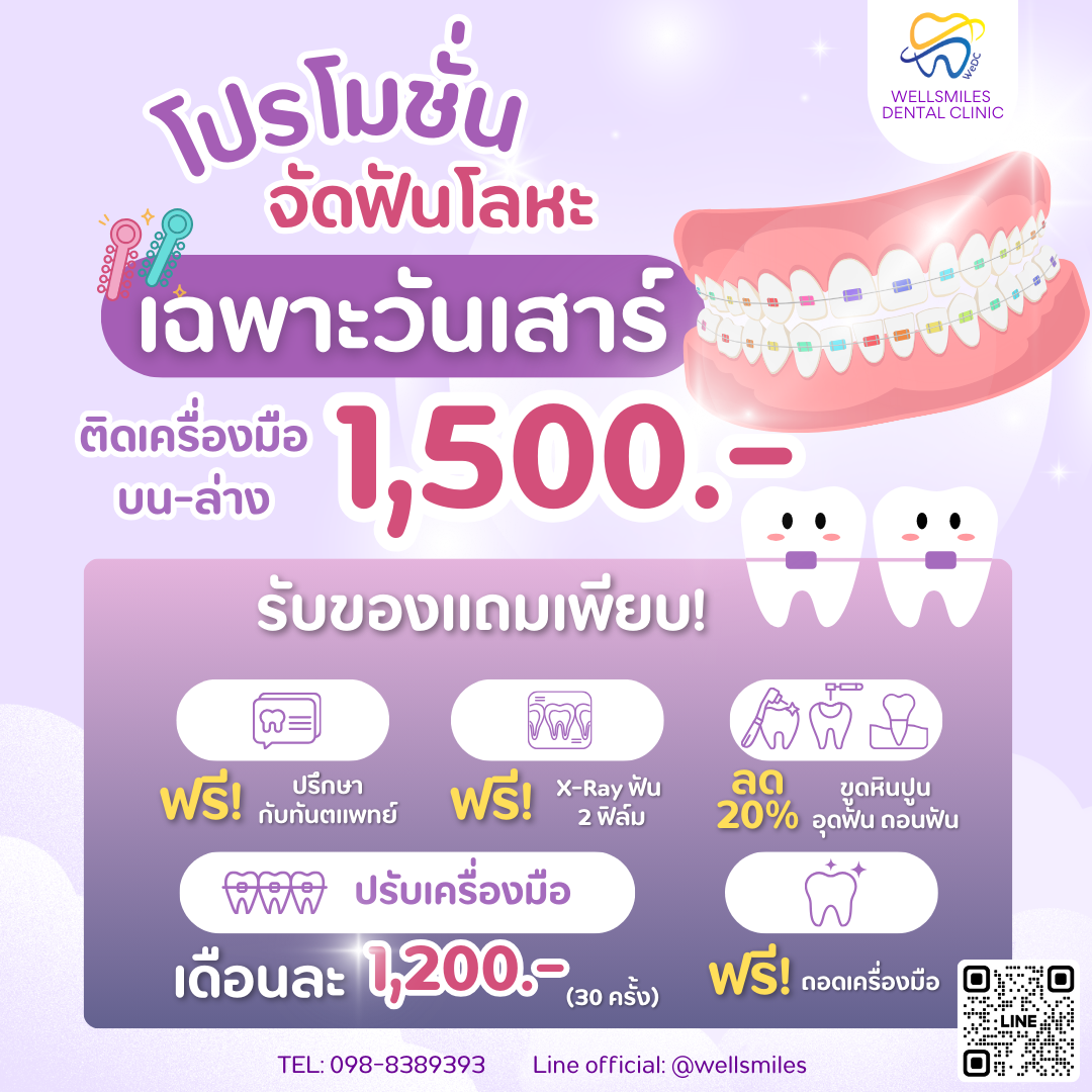 จัดฟันวันเสาร์ (1)
